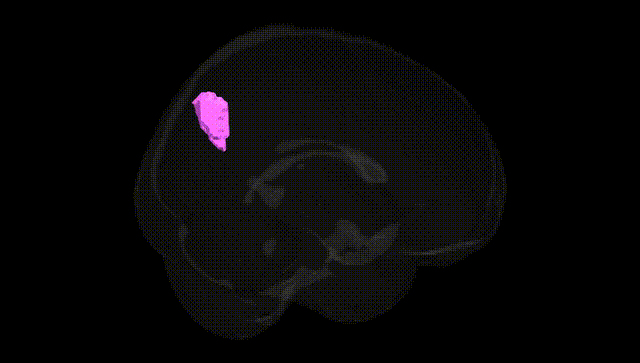 Full Brain Black