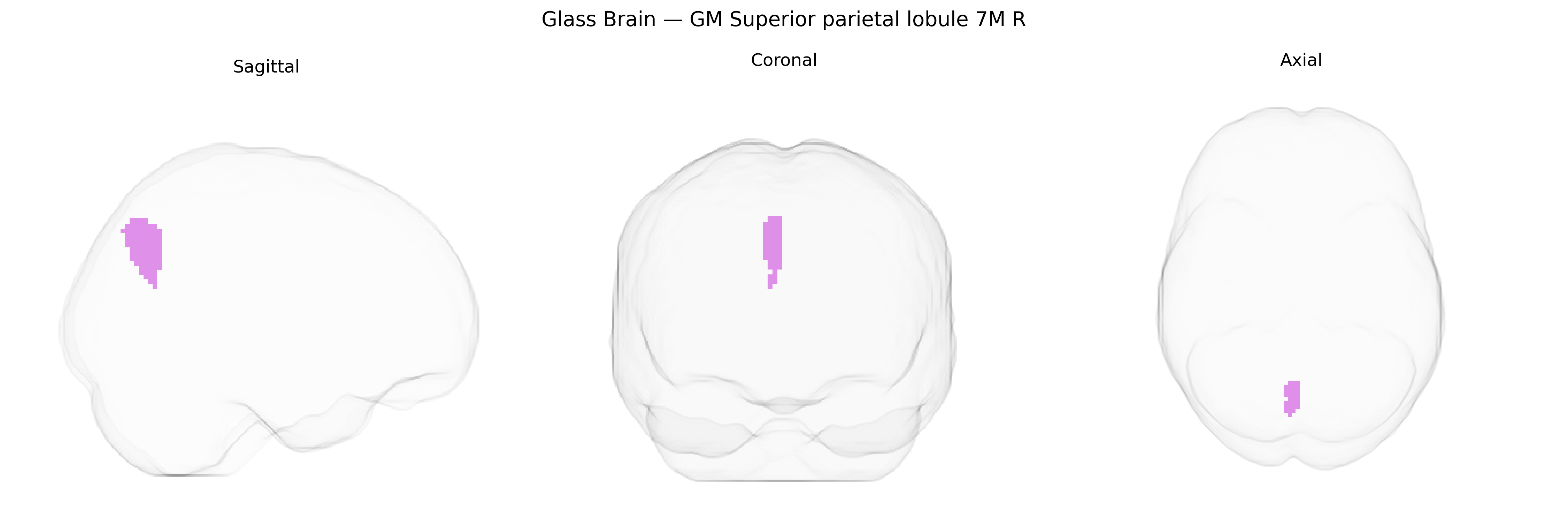 Triplanar Ghost Brain