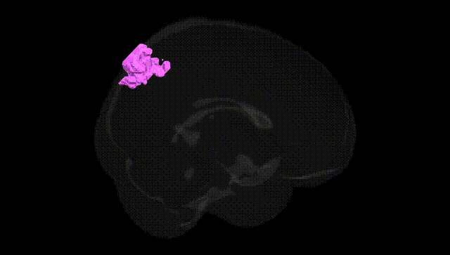 Full Brain Black