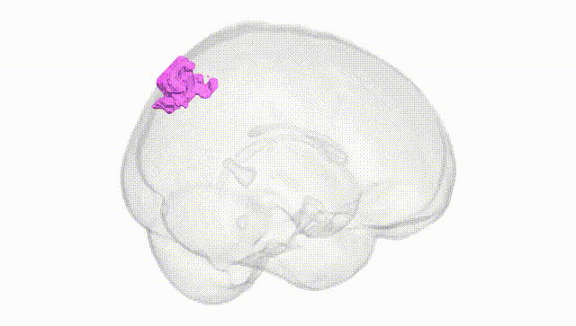 Full Brain White