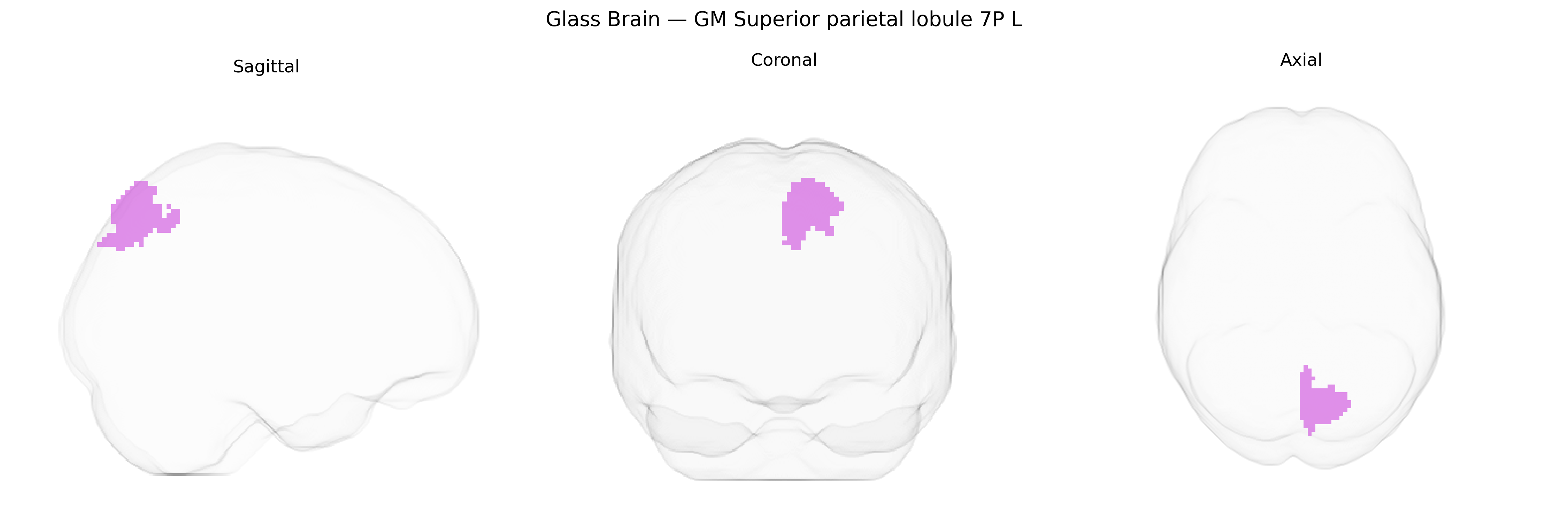 Triplanar Ghost Brain