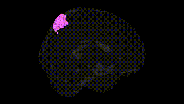 Full Brain Black