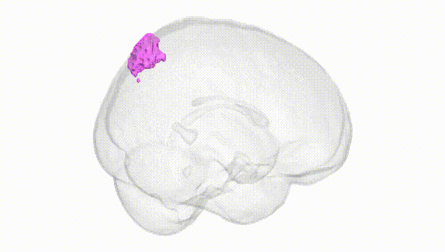 Full Brain White