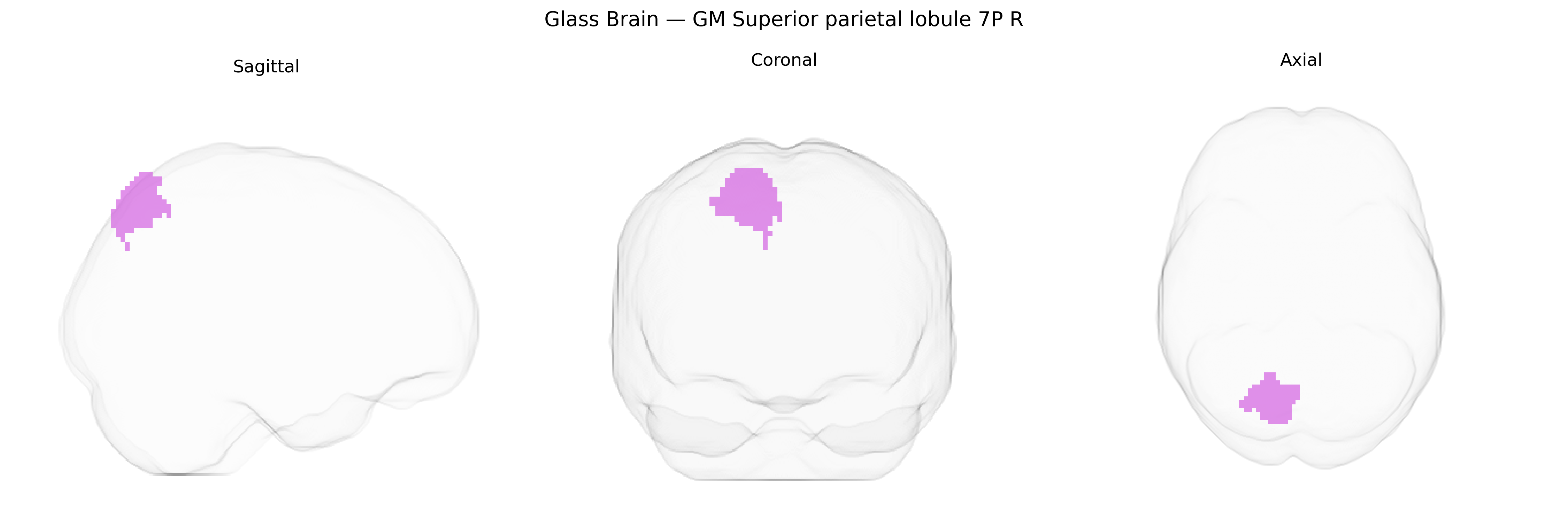Triplanar Ghost Brain