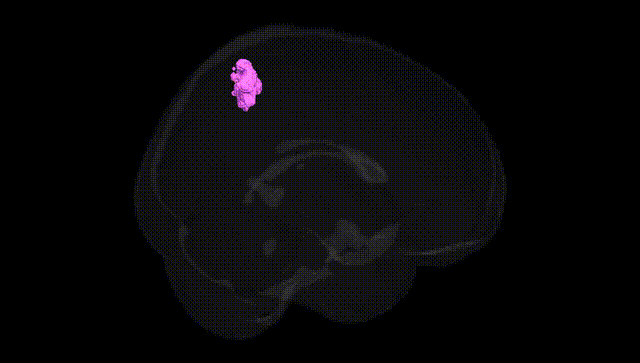 Full Brain Black
