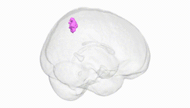 Full Brain White
