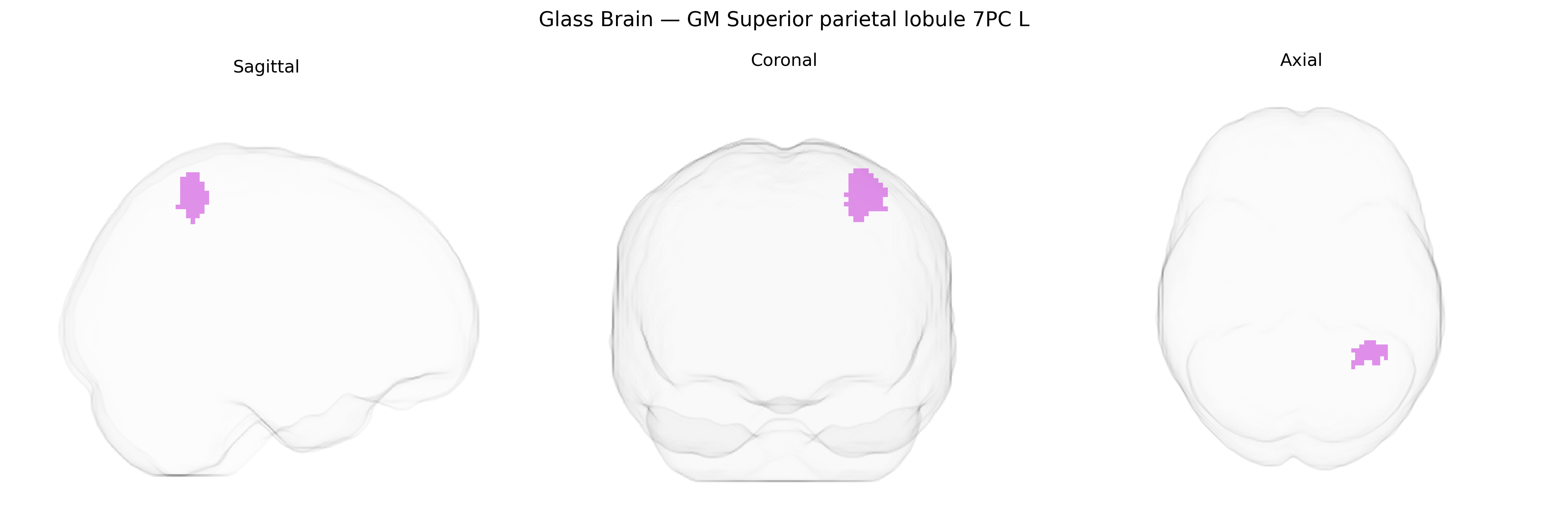 Triplanar Ghost Brain