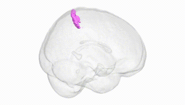 Full Brain White