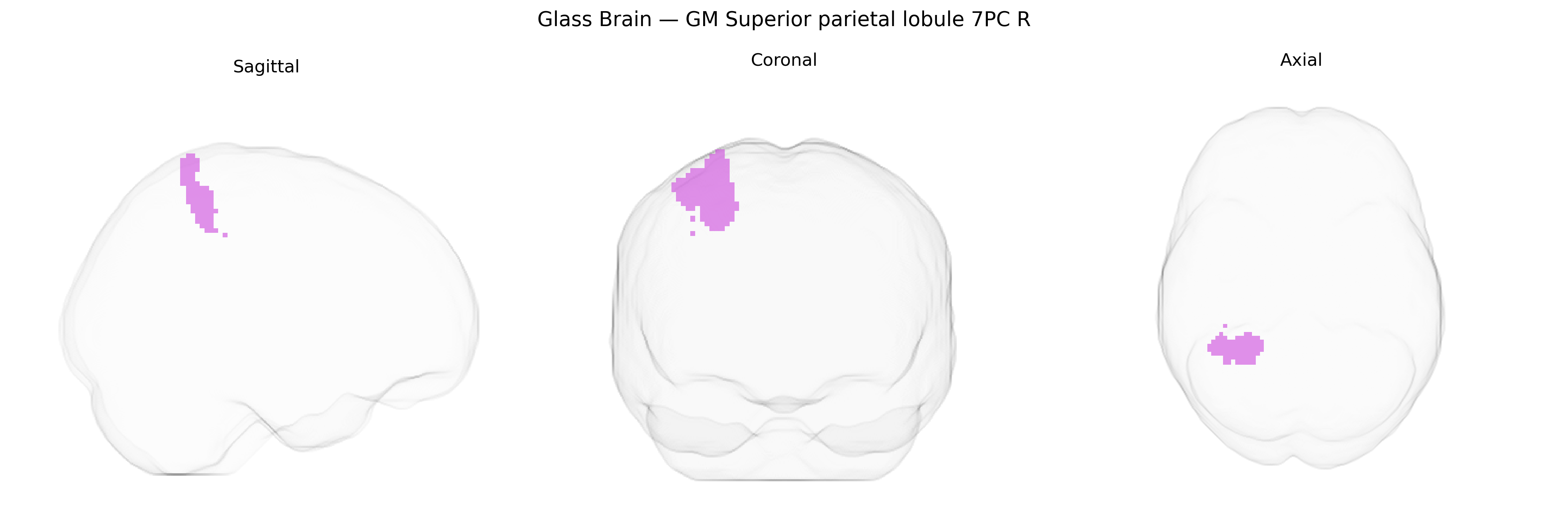 Triplanar Ghost Brain