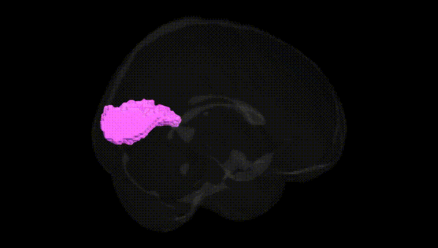 Full Brain Black