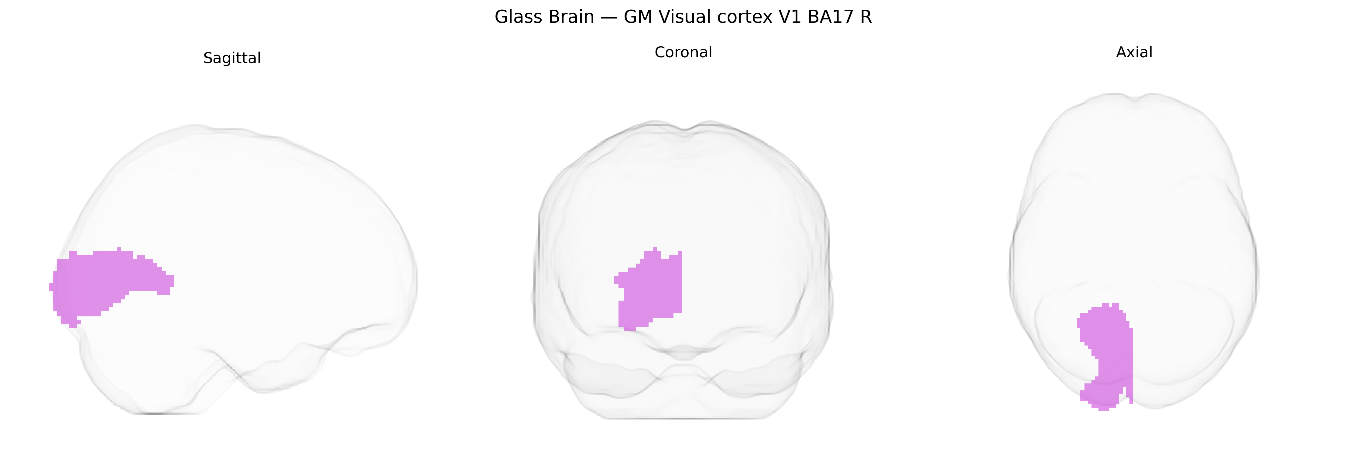 Triplanar Ghost Brain