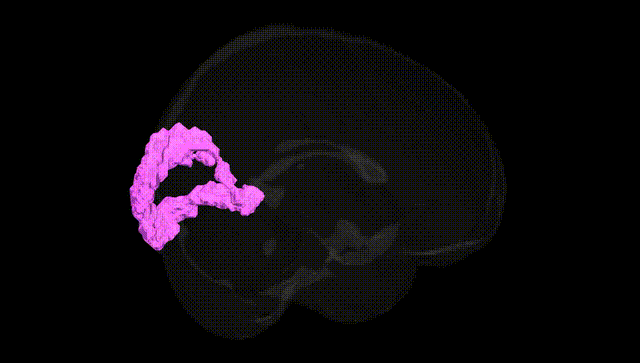 Full Brain Black