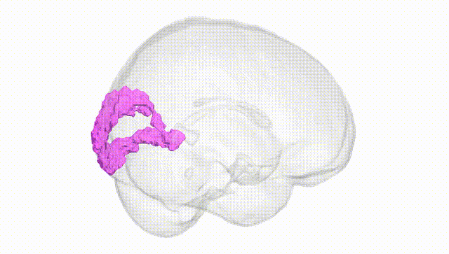Full Brain White