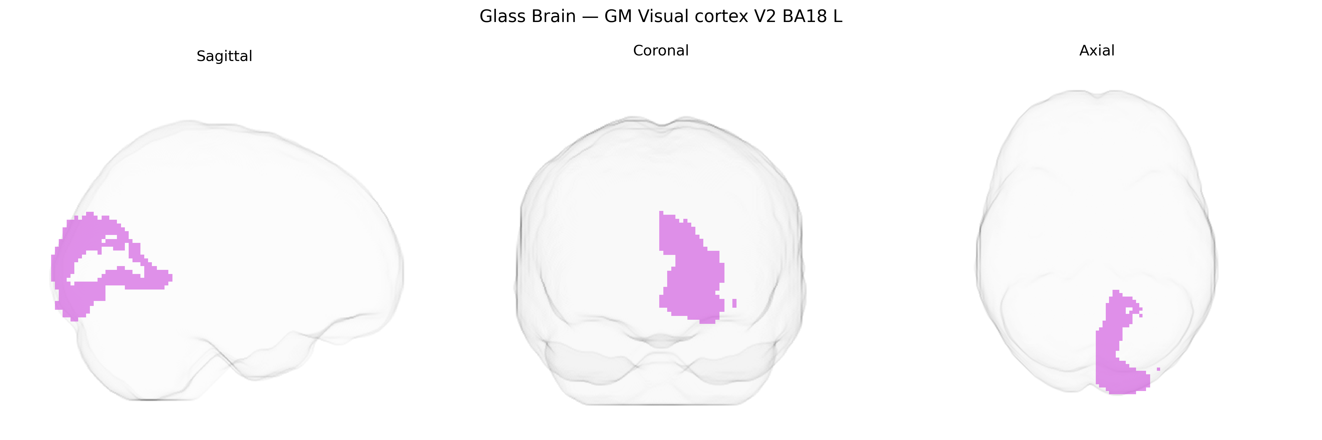 Triplanar Ghost Brain