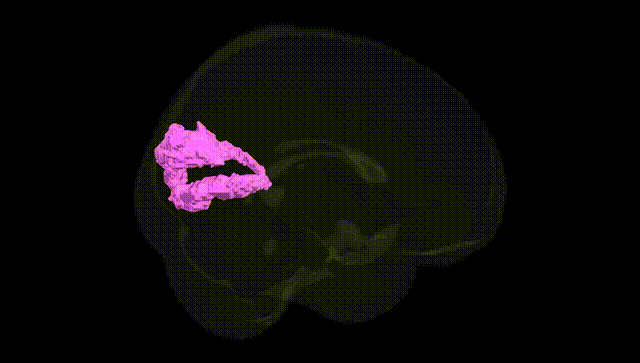 Full Brain Black