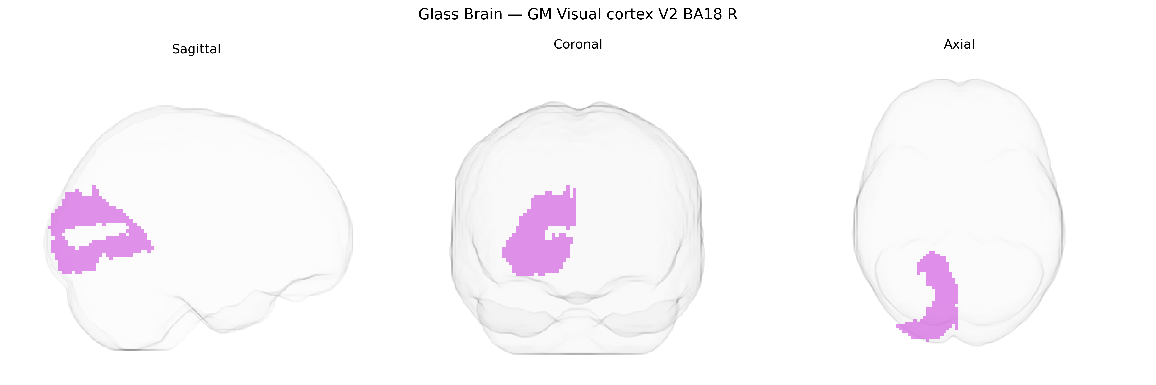 Triplanar Ghost Brain