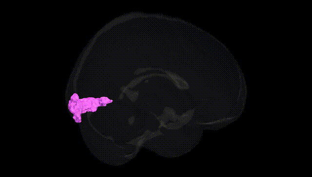 Full Brain Black