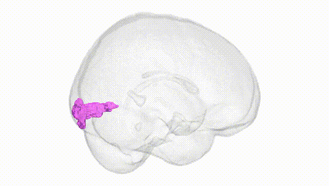 Full Brain White