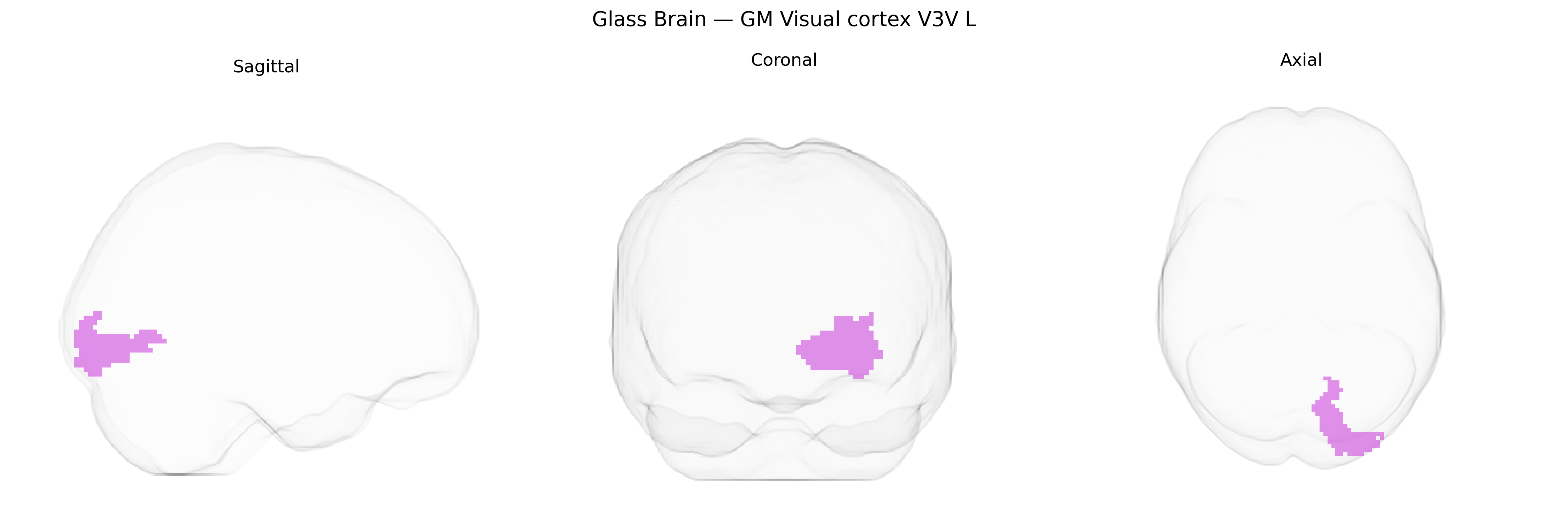 Triplanar Ghost Brain