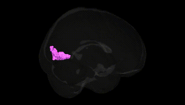 Full Brain Black