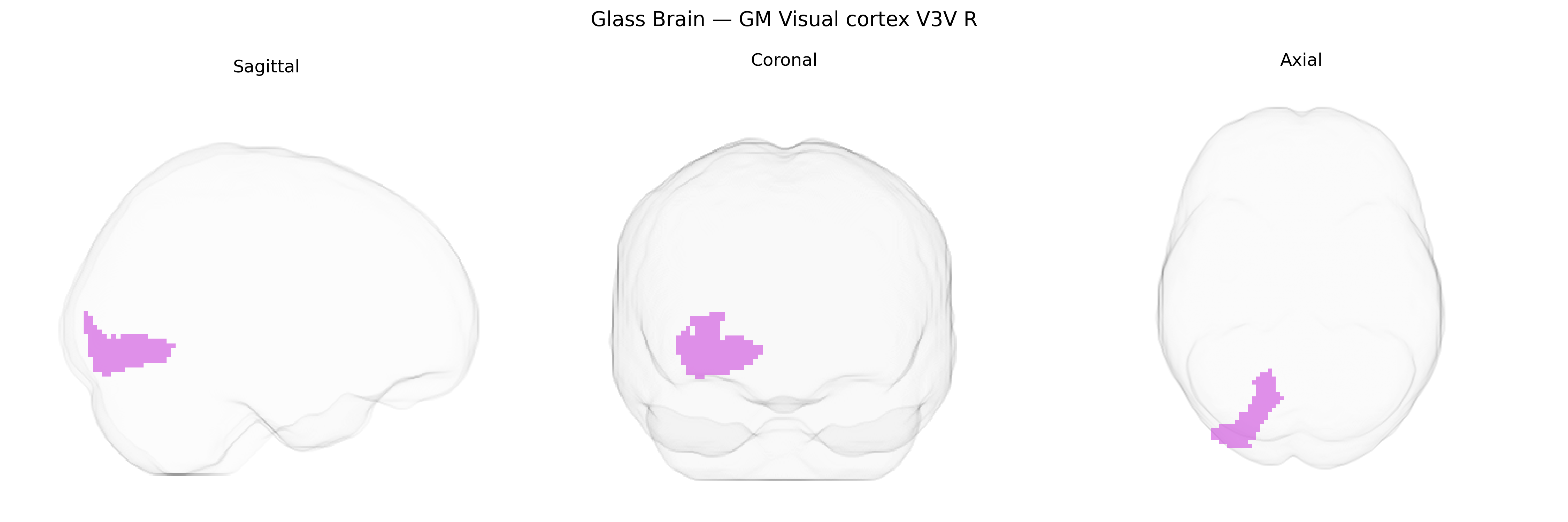Triplanar Ghost Brain