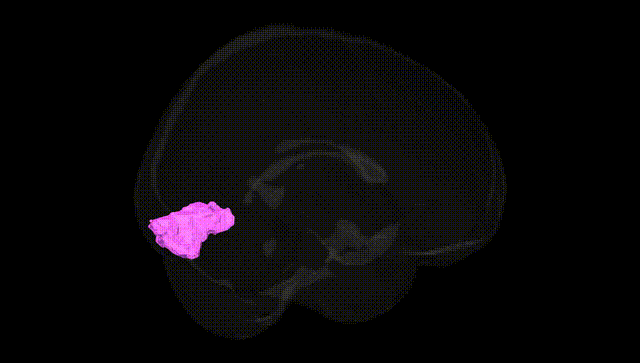 Full Brain Black