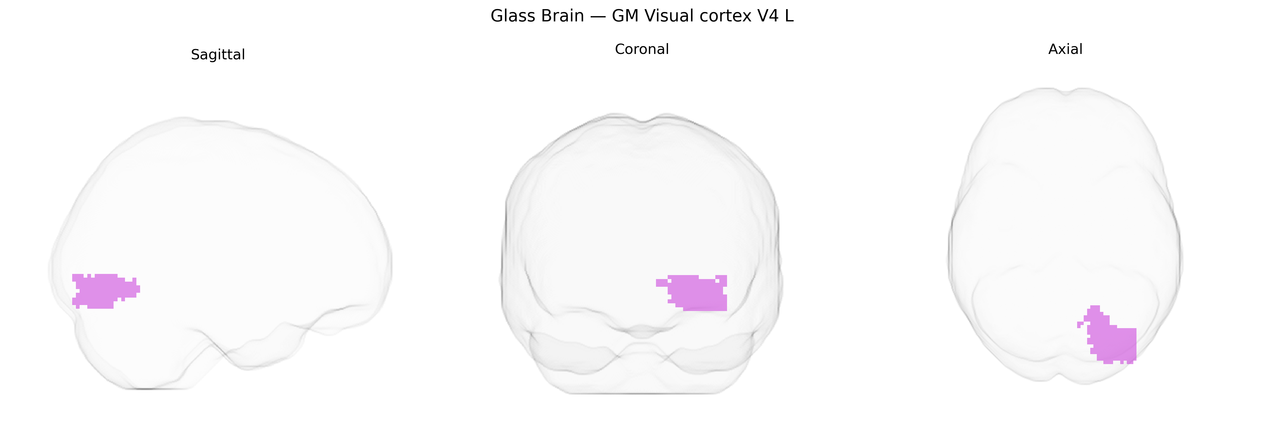 Triplanar Ghost Brain