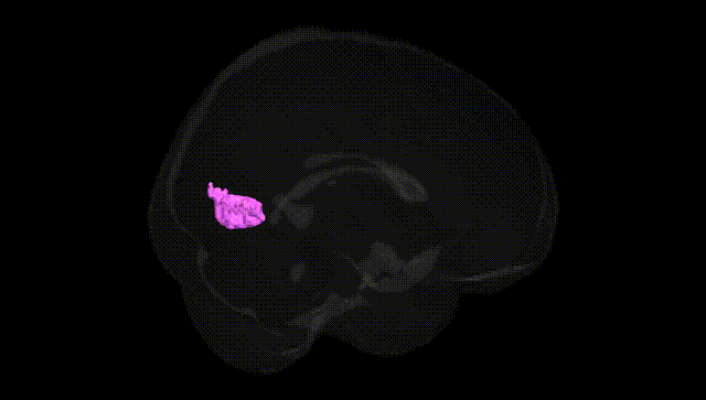 Full Brain Black