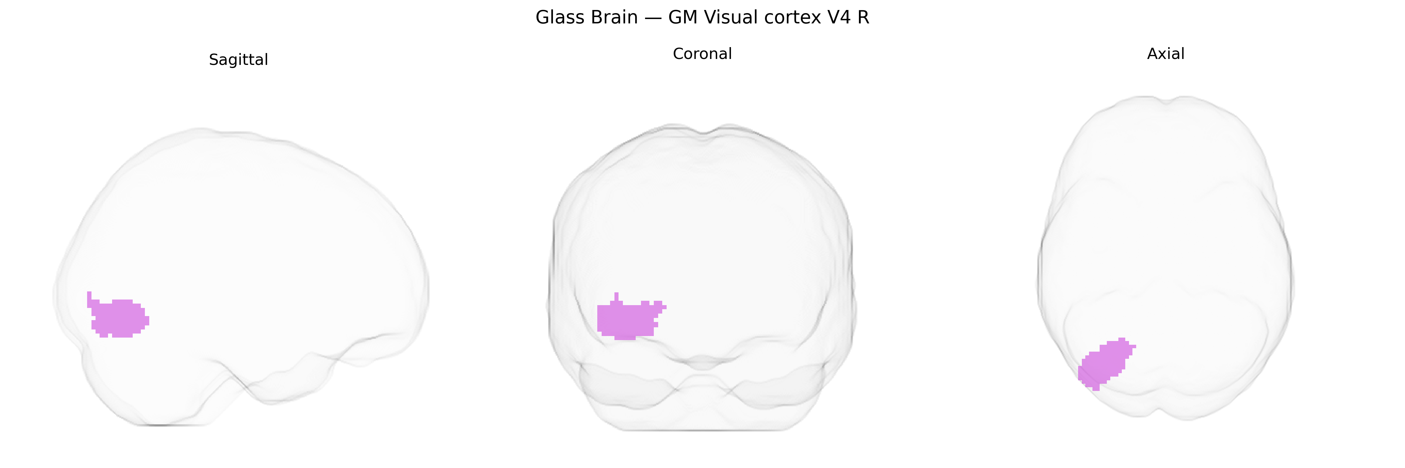 Triplanar Ghost Brain