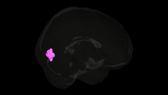 Full Brain Black