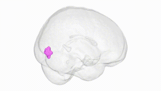 Full Brain White