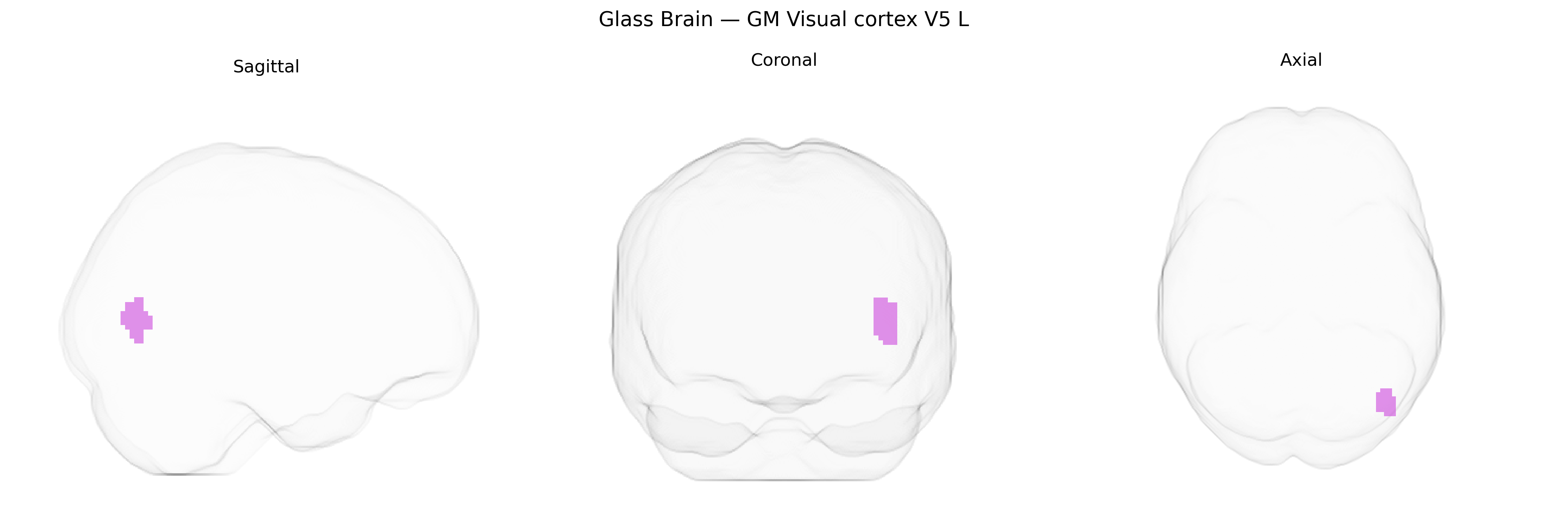 Triplanar Ghost Brain