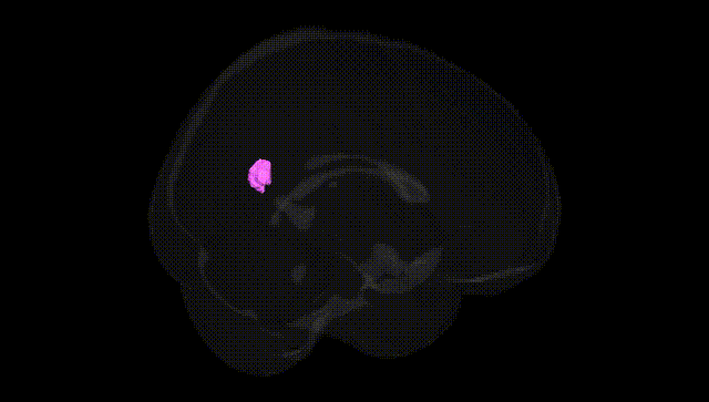 Full Brain Black