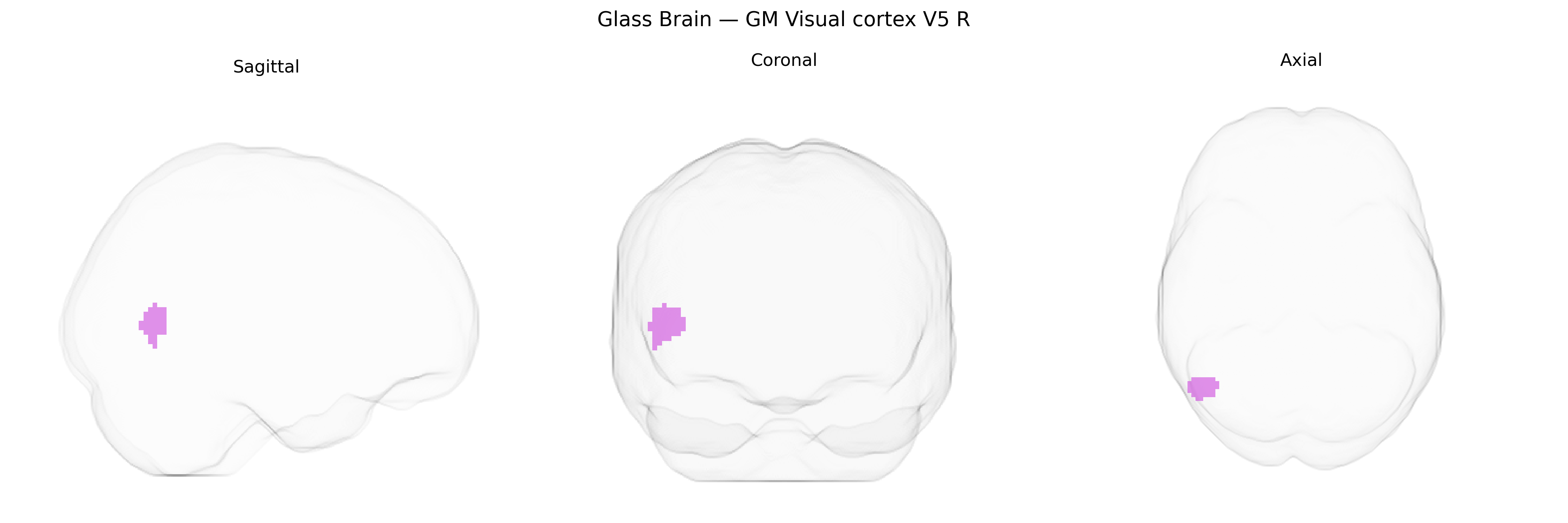 Triplanar Ghost Brain
