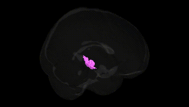 Full Brain Black