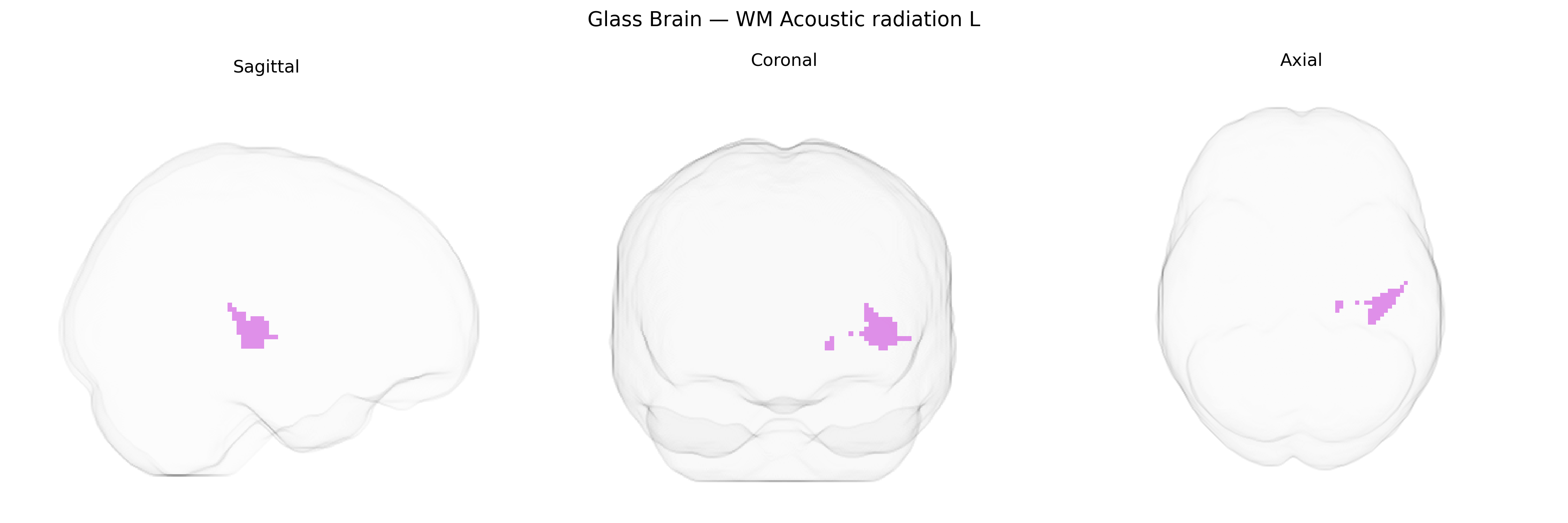 Triplanar Ghost Brain