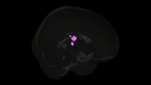 Full Brain Black