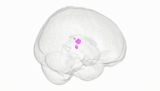 Full Brain White
