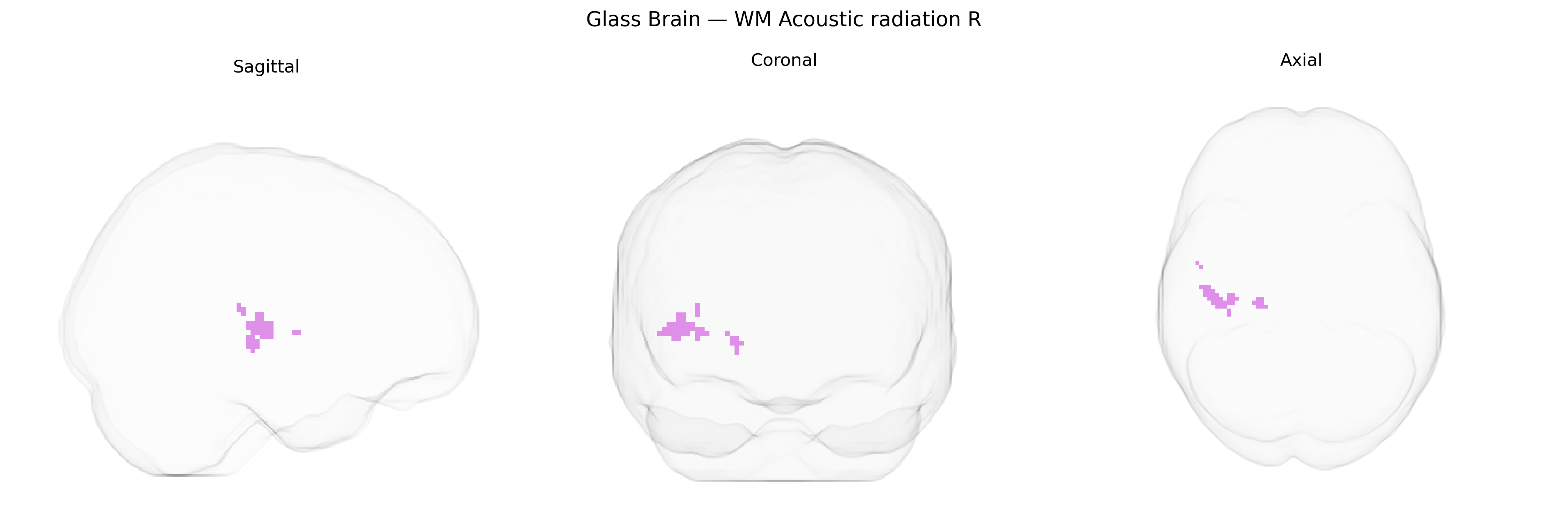 Triplanar Ghost Brain