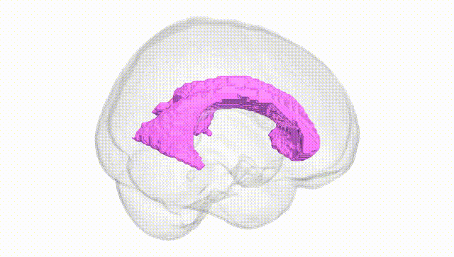 Full Brain White