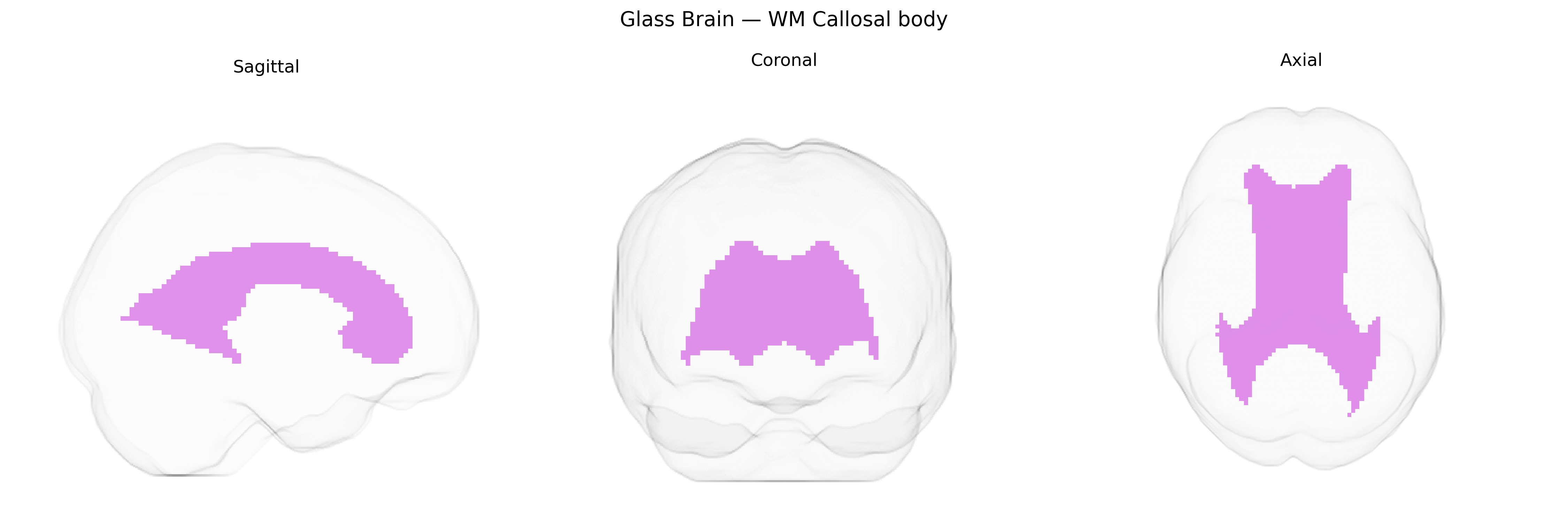 Triplanar Ghost Brain
