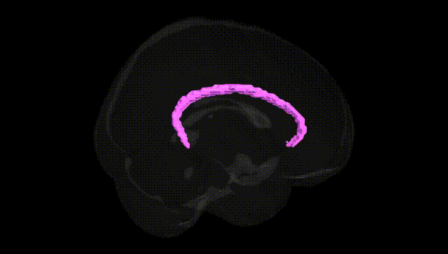 Full Brain Black