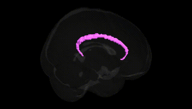 Full Brain Black