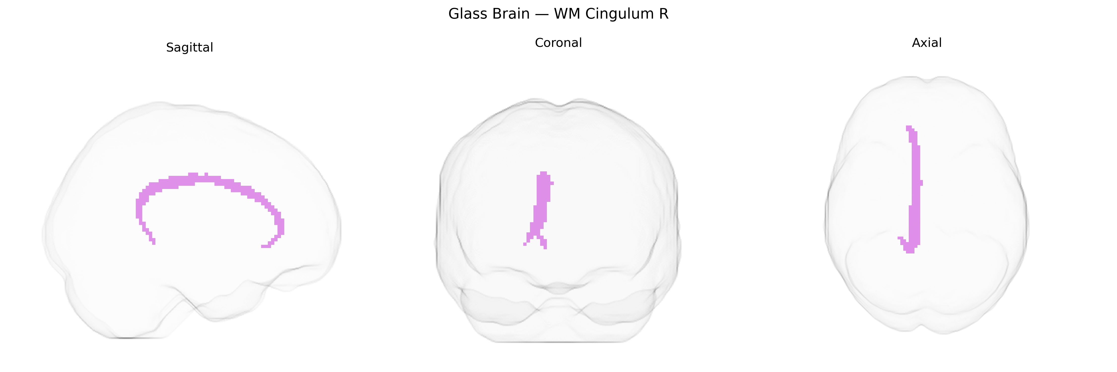 Triplanar Ghost Brain