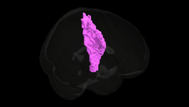Full Brain Black
