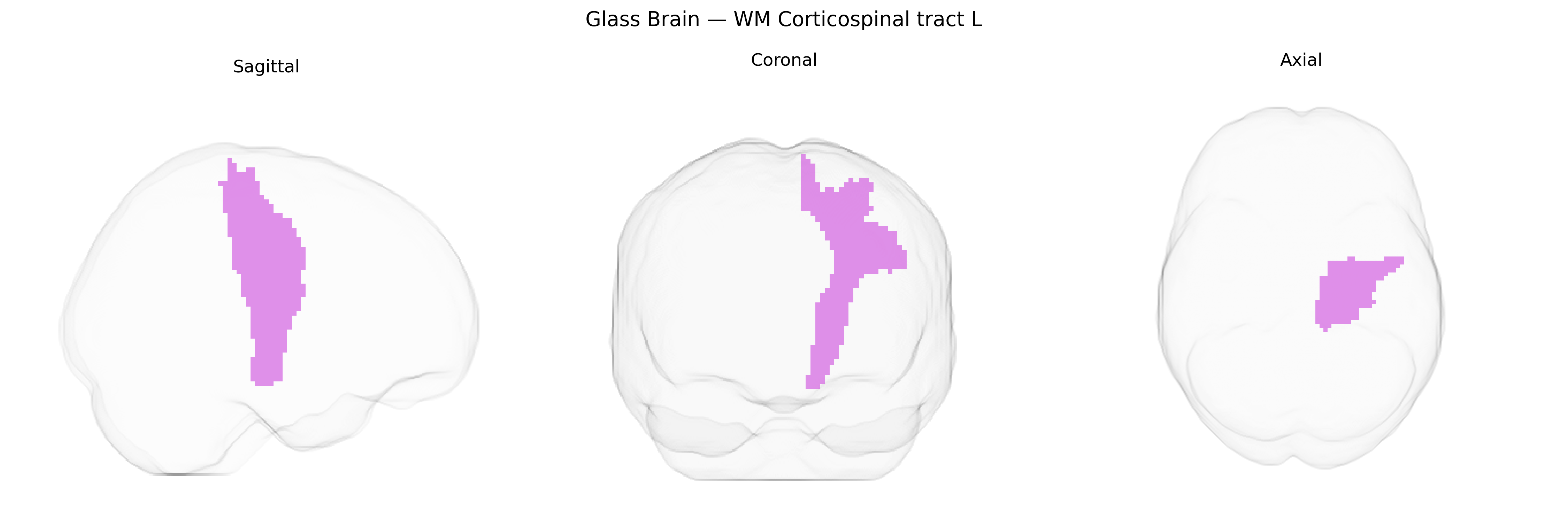 Triplanar Ghost Brain