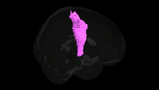 Full Brain Black