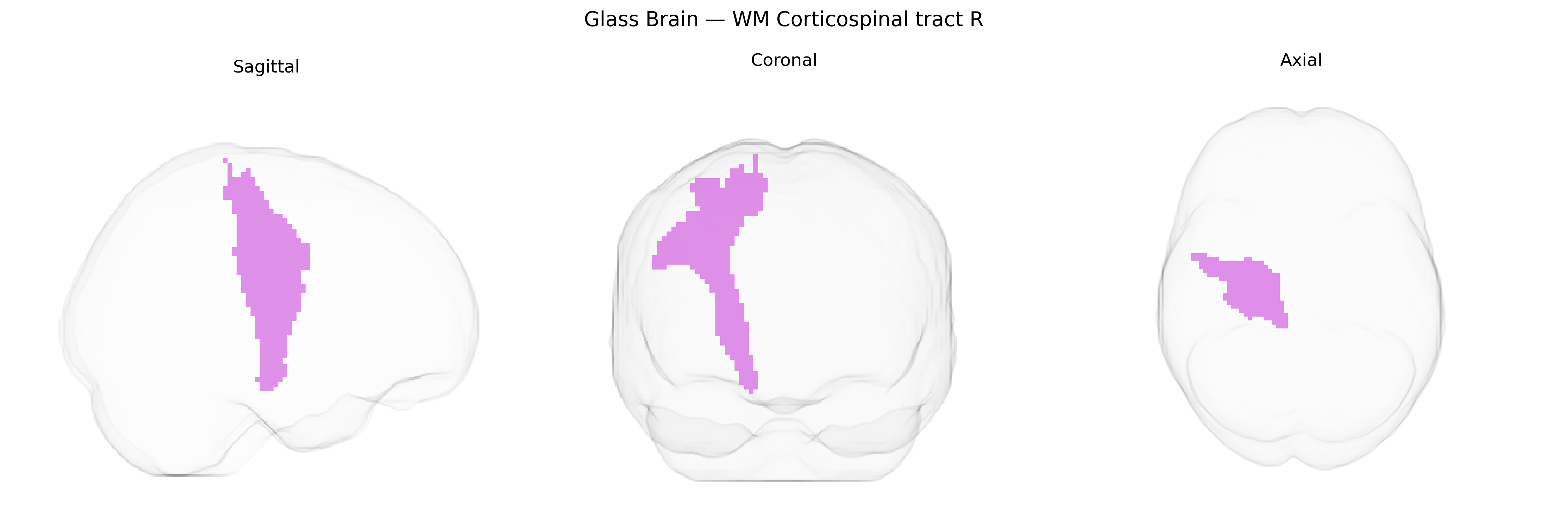 Triplanar Ghost Brain