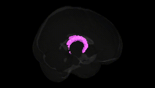 Full Brain Black