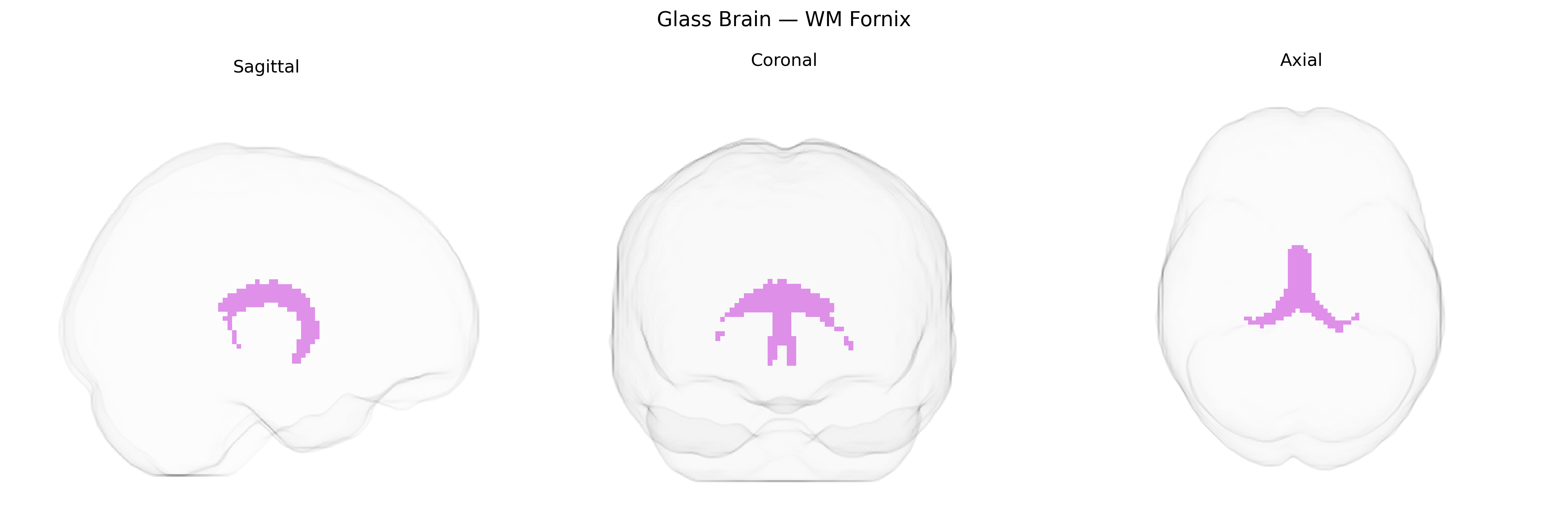 Triplanar Ghost Brain